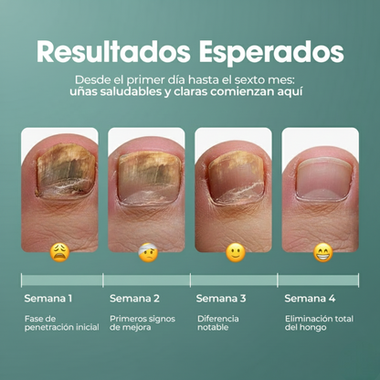 FUNGICLEAR : El aceite que elimina y previene el 99.9% del pie de atleta